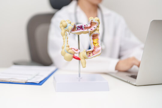 Doctor with human Colon anatomy model. Colonic disease, Large Intestine, Colorectal cancer, Ulcerative colitis, Diverticulitis, Irritable bowel syndrome, Digestive system and Healthcare concept