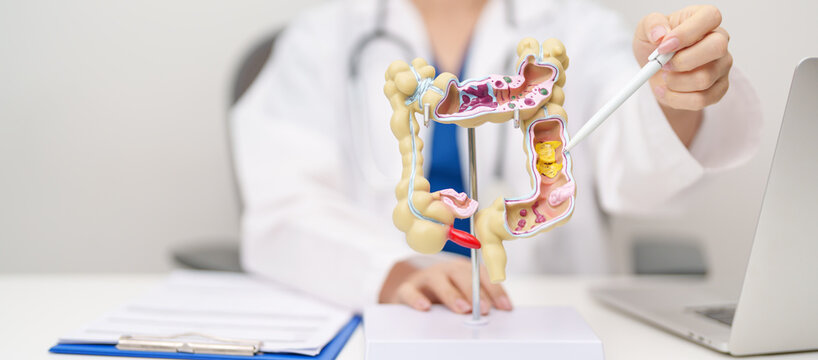 Doctor with human Colon anatomy model. Colonic disease, Large Intestine, Colorectal cancer, Ulcerative colitis, Diverticulitis, Irritable bowel syndrome, Digestive system and Healthcare concept