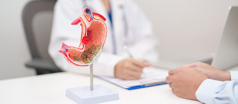 Doctor with Gastric anatomy model. Gastroenterologist consultation, stomach diseases and ulcers, November stomach cancer, Gastroesophageal Reflux Disease, GERD, Acid reflux and healthcare medical