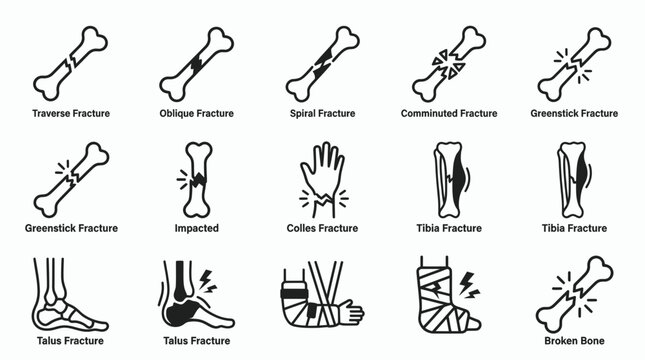 Common bone fracture types and orthopedic injury line icon set