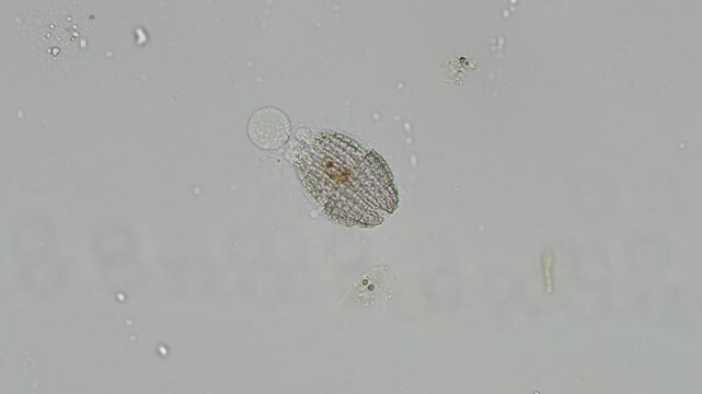 Coleps ciliate at 20x under brightfield microscopy