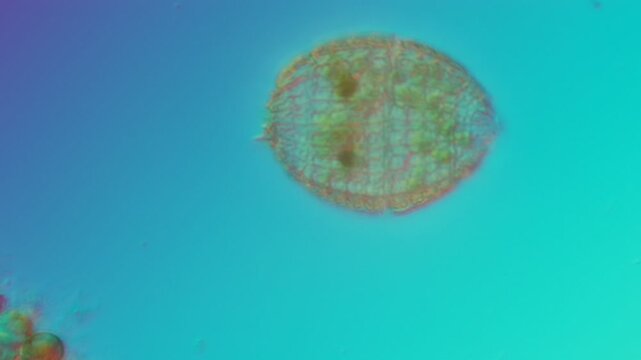 Coleps protist at 50x under Nomarski DIC microscopy