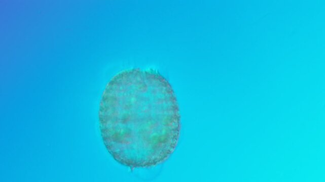 Coleps ciliate detail at 50x under Nomarski DIC
