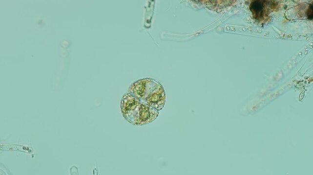 Cosmarium botrytis desmid at 20x under Nomarski DIC