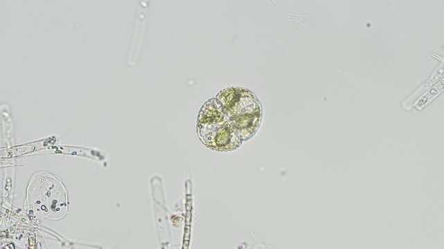 Cosmarium botrytis desmid at 20x under brightfield