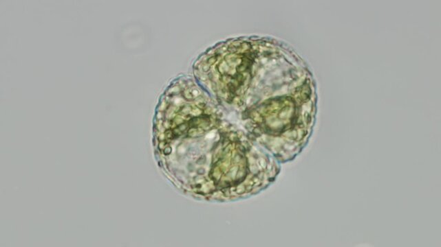 Cosmarium botrytis desmid close-up at 50x brightfield