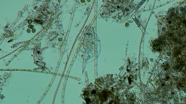 Euchlanis dilatata rotifer at 10x under Nomarski DIC