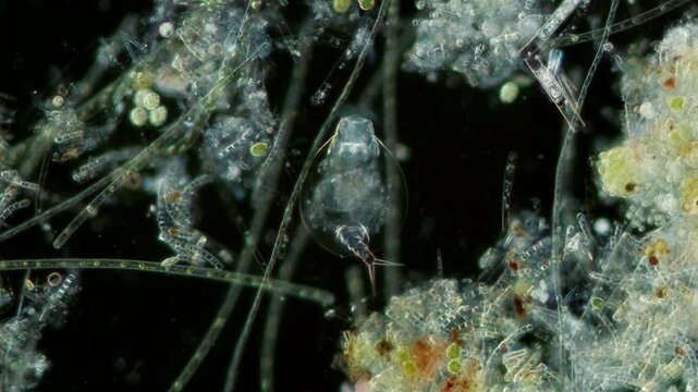 Euchlanis rotifer at 10x under darkfield microscopy