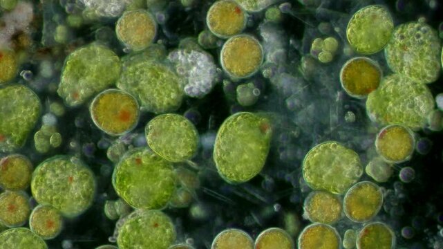 Euglena palmelloid stage at 20x under darkfield