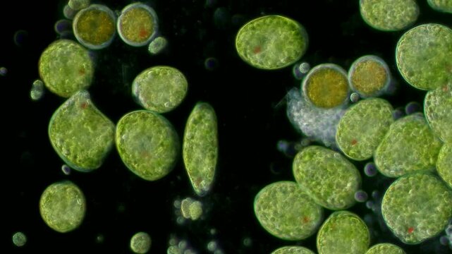 Euglena palmelloid cells at 20x under darkfield