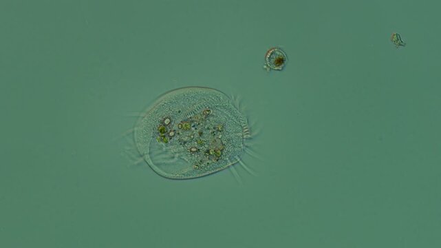 Euplotes ciliate at 20x under Nomarski DIC microscopy