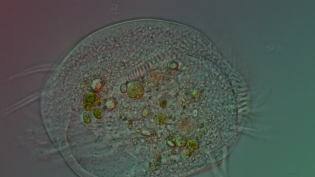 Euplotes ciliate close-up at 50x under Nomarski DIC