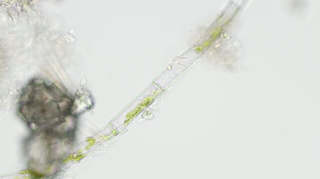 Microspora amoena filament at 20x under brightfield