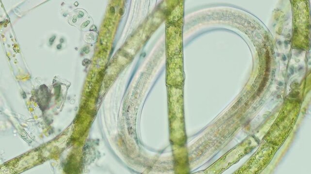 Microspora green algae at 20x under brightfield microscopy