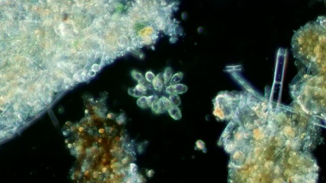 Synura colony at 20x under darkfield microscopy