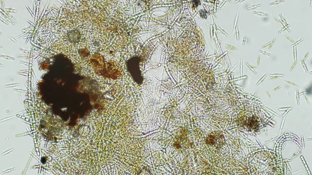 Tachysoma pellionellum at 10x under brightfield microscopy