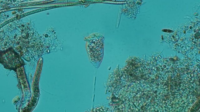 Vorticella ciliate at 20x under Nomarski DIC microscopy