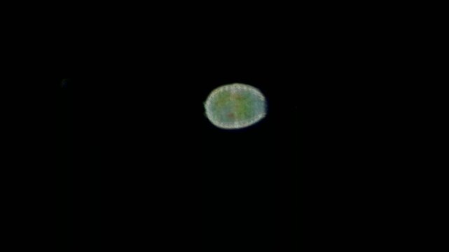 Coleps ciliate at 20x under darkfield microscopy