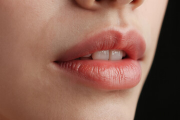 Naklejka premium Full lips with subtle gloss show dental care and cosmetic enhancement. Mouth area implies beauty procedures for facial rejuvenation. Natural healthy look achieved.