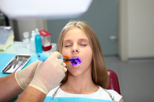 Filling of baby teeth. Girl with long blonde hair at dentist appointment. Wireless LED polymerization lamp in hands of doctor. Concept of pediatric dentistry