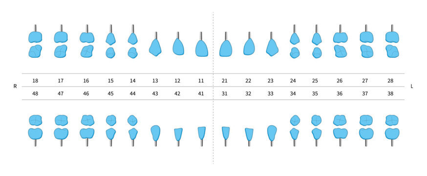 Tooth crown and dental prosthesis implant chart. Adult teeth dentist numbering system. Upper and lower filled teeth implantation scheme. Realistic medicine infographic design. Vector illustration.