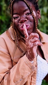 young African American woman with vitiligo poses playfully with a "shh" gesture, indicating silence. expression is fun, light-hearted joy and individuality. self-expression, positivity advertising