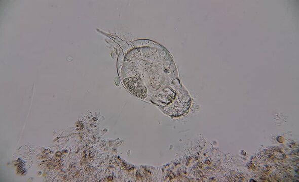 image of aquatic microorganisms under the microscope