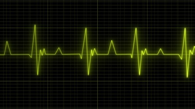  Glowing neon line heartbeat icon. Abstract neon heartbeat signal icon animation .  Sundar background. Green Yellow Color heartbeat signal animation , Heart bit  