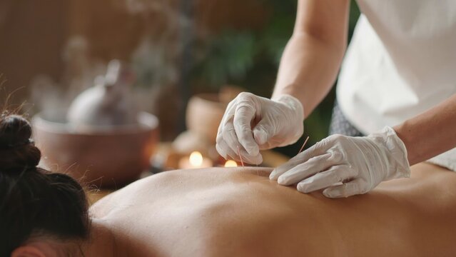 Acupuncturist inserting needle into patient's back in spa setting