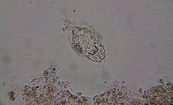 image of aquatic microorganisms under the microscope