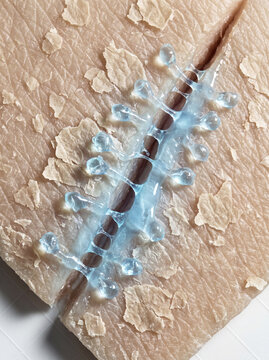 Xenobots Sealing Skin Barrier Microcrack In Dermatology Macro Landscape
