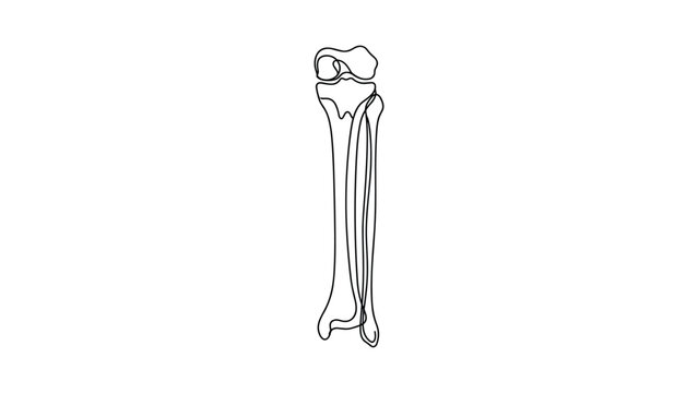 Anatomical line drawing of human lower leg bones showing tibia and fibula.