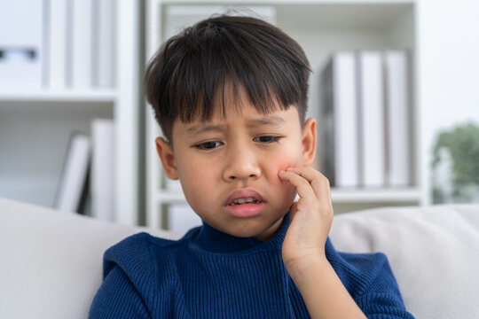 Mosquito bite, asian boy scratching itchy face from insect bite, child health, pediatric care, allergic reaction, skin irritation, healthcare, dengue fever, dermatology and viral disease prevention