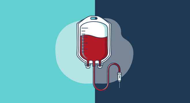 Medical Infusion Illustration Showing Intravenous Therapy Process For Healthcare Needs Analysis