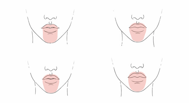 Vector illustration set of four female chin and jawline shapes shown in line art style with highlighted pink areas for facial anatomy and aesthetic comparison.