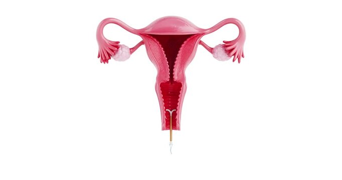 4k Resolution Video:  IUD Usage Instruction Concept. Female Reproductive System Uterus With Copper Contraceptive Device Animated On White Background With Alpha Matte