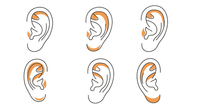 Set of six female ear shape variations in minimal line art style with orange highlights, depicting anatomical diversity for cosmetic surgery, medical diagrams, or beauty guides.