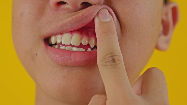 Young man checks gums and teeth pointing at mouth in studio setting