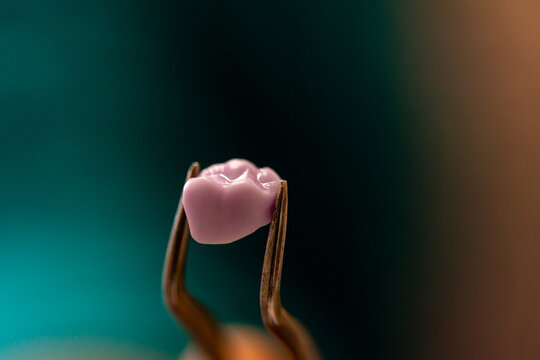 Pink Dental Crown Held by Forceps Close Up