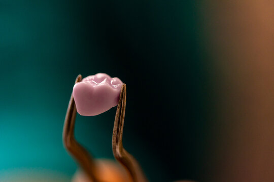 Pink Dental Crown Held by Forceps Close Up
