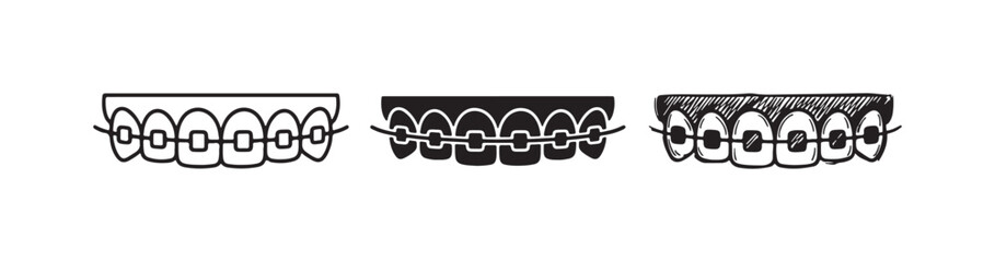 Upper jaw teeth with dental braces set in outline, solid black, and hand-drawn sketchy styles, isolated on white background © Ірина Гринюк
