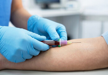 Blood sampling procedure in hospital close up. © Moree