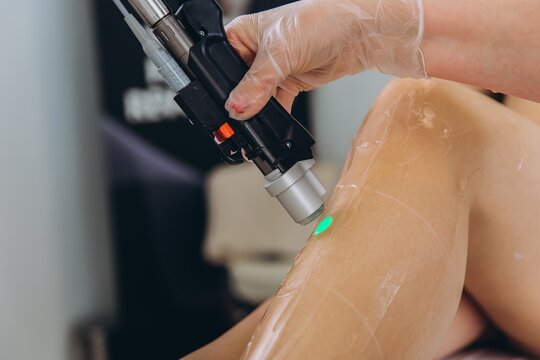 Professional performing laser hair removal on leg in clinic