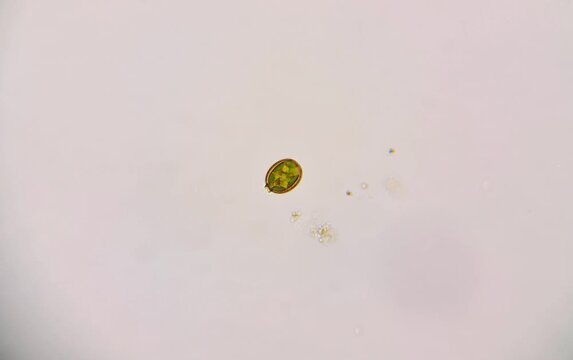 microorganisms in water, euglena Trachelomonas