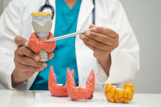 Hyperthyroidism, Overactive Thyroid, Thyroid Lymphoma, Asian doctor with thyroid gland human anatomy model in hospital.