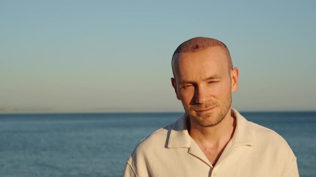 A portrait of a content, pleasantly smiling Caucasian man displaying his healing scalp with scabs after a recent hair transplant procedure, standing outdoors against the sunset ocean