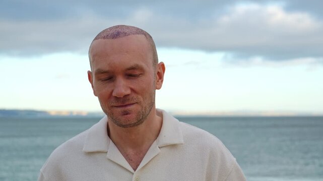 A portrait of a happy, smiling Caucasian man displaying his healing scalp with scabs after a recent hair transplant procedure, standing outdoors against an overcast sea view