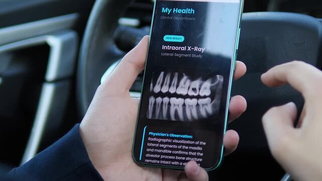 Scrolling through a physicians conclusion on a mobile device. The screen highlights radiographic signs of dental caries in tooth 1.6 with red text. Great for showcasing diagnostic reports, patient