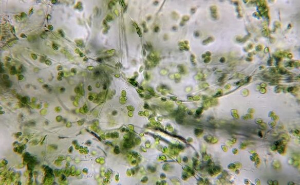 microscope image of leaf
