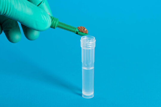 The laboratory technician's hand lowers a spatula with a stool sample into a test tube to examine the stool for intestinal dysbiosis and microflora. Copy space for text